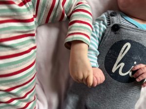 Herzkind: „Unser Baby kam mit komplexem Herzfehler zur Welt“